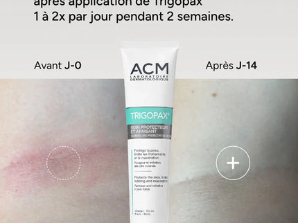 ACM TRIGOPAX Soin Protecteur Apaisant - 75g